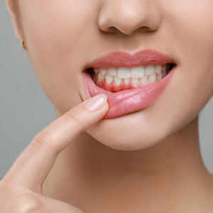 Treat gum disease near Wrightsville Beach