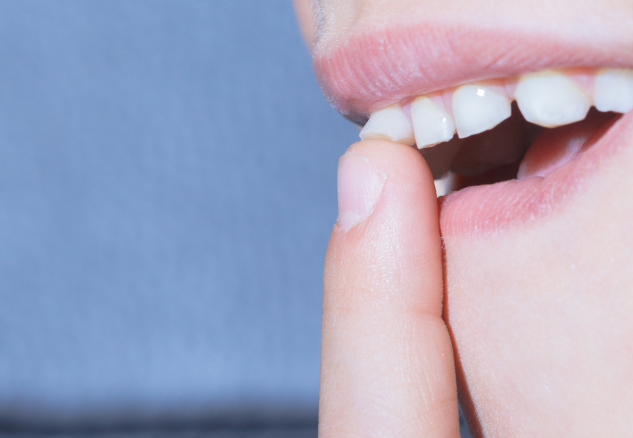 Close up of loose tooth